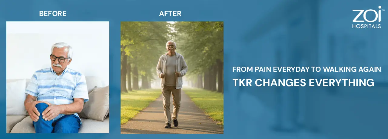 ZoiHospitals-Knee2